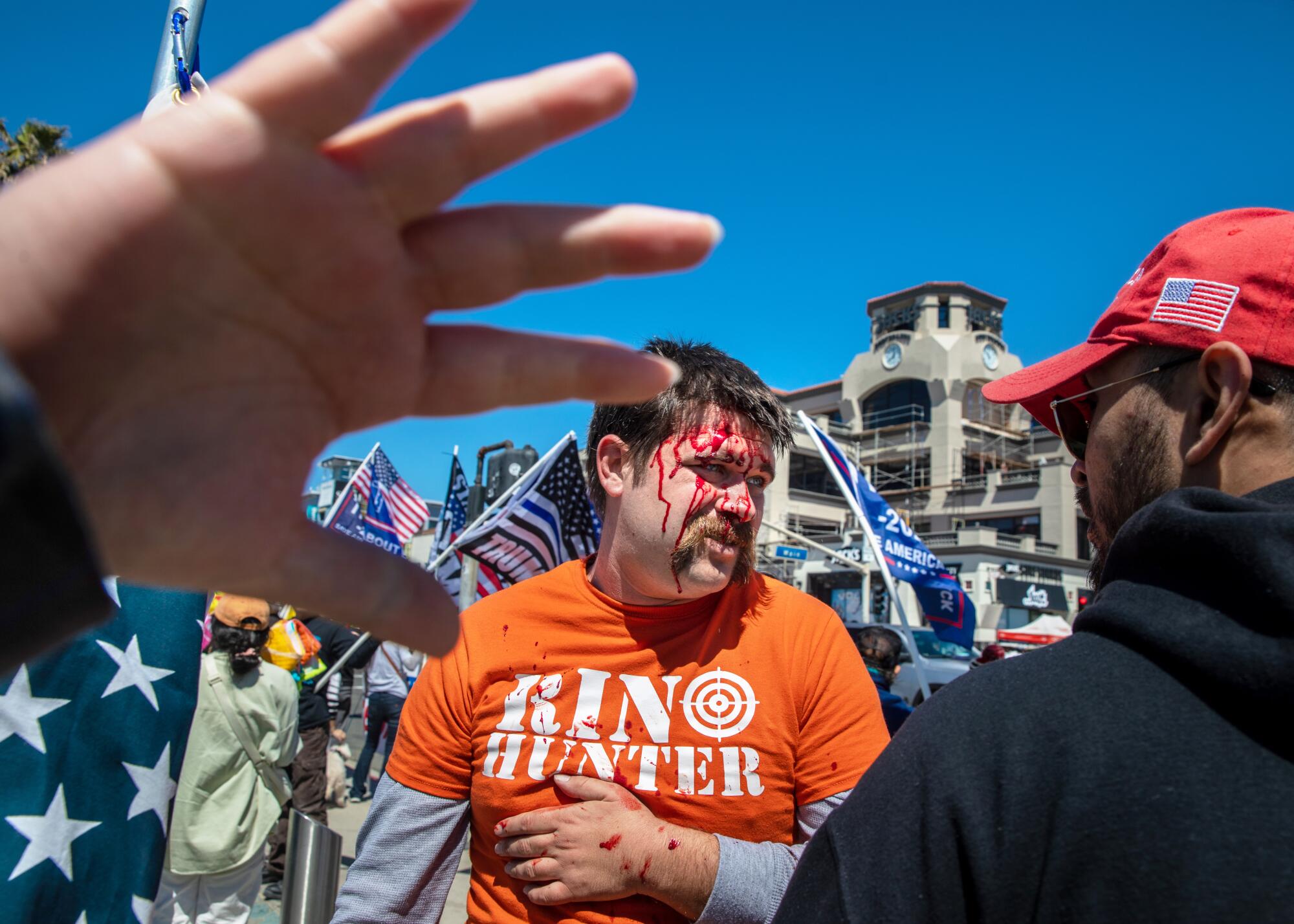 A man wearing a T-shirt that reads "RINO Hunter" bleeds from his head 