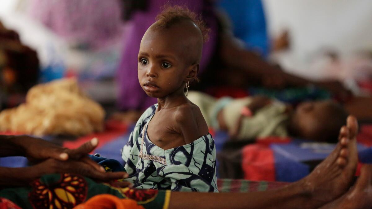 Malnourishment is one of the dangers faced by children fleeing Boko Haram violence in Nigeria.