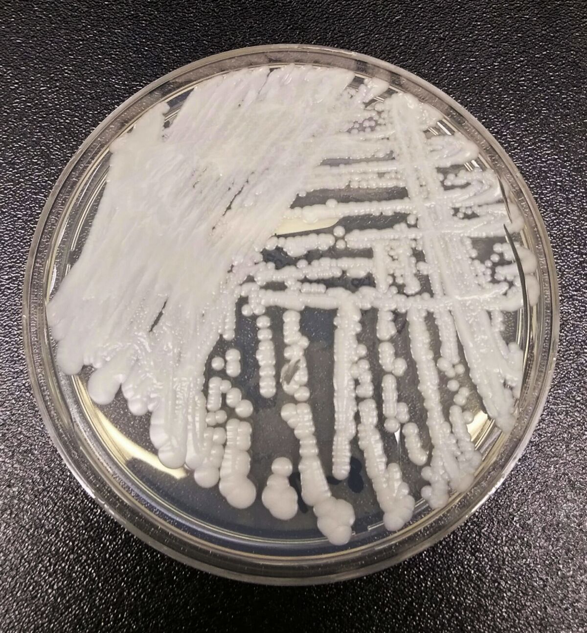 una cepa de Candida auris cultivada en una placa de petri 