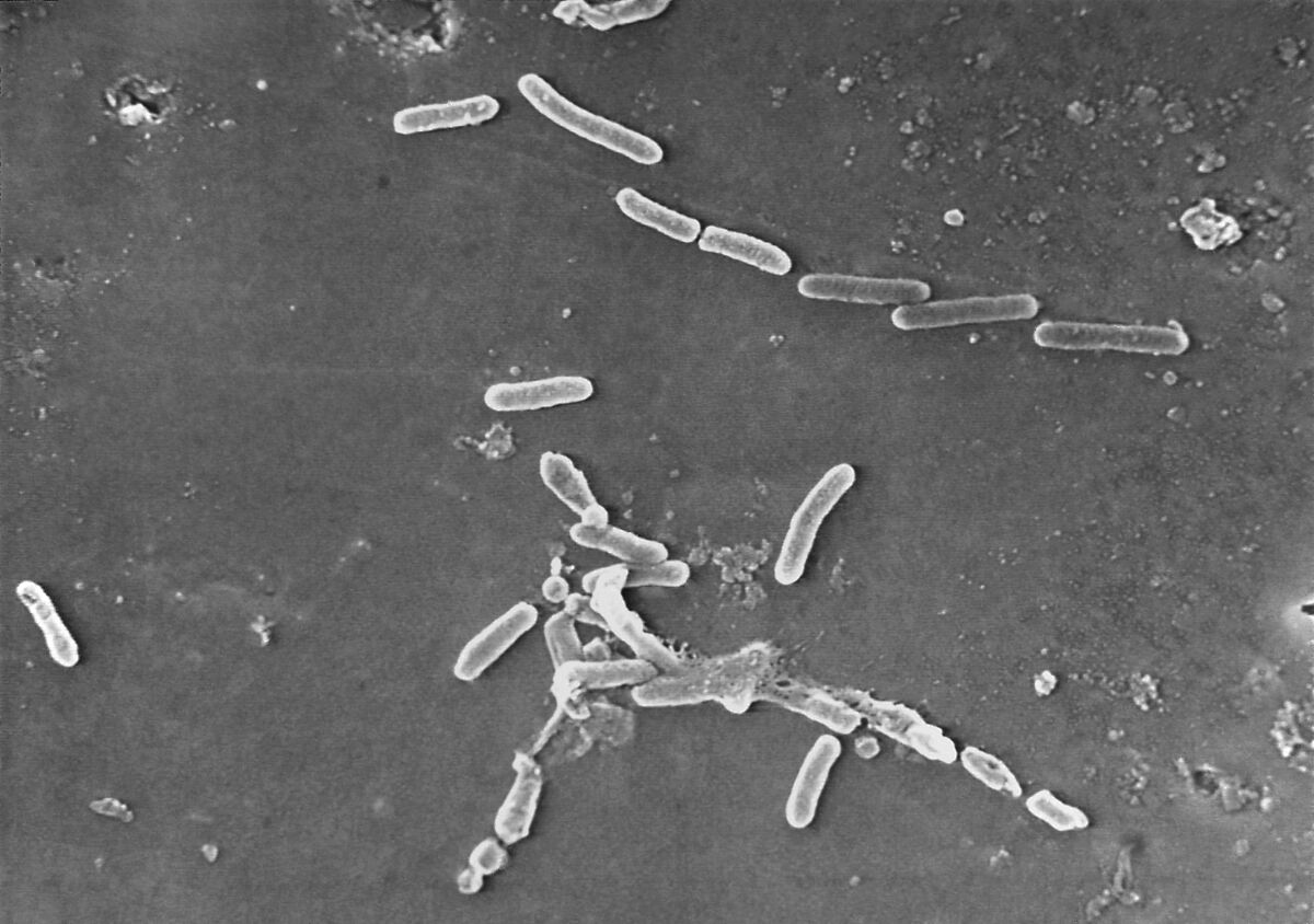 FILE - This scanning electron microscope image made available by the Centers for Disease Control and Prevention shows rod-shaped Pseudomonas aeruginosa bacteria. U.S. officials are reporting two more deaths and additional cases of vision loss linked to eyedrops tainted with the drug-resistant bacteria. The eyedrops from EzriCare and Delsam Phama were recalled in February 2023 and health authorities are continuing to track infections as they investigate the outbreak. (Janice Haney Carr/Centers for Disease Control and Prevention via AP, File)
