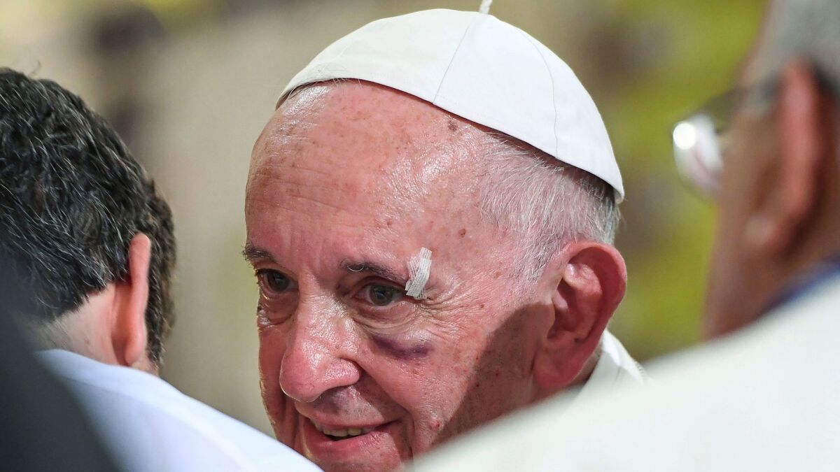 Pope Francis, who hit his head on the popemobile, proceeds with a visit to the Sanctuary of St. Peter Claver in Cartagena, Colombia, on Sept. 10, 2017.