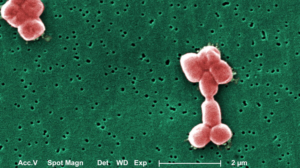 New type of antibiotic targets drug-resistant bugs, study says - Vimarsana News