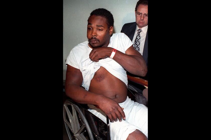 Rodney King shows the bruises he sustained at the hands of four Los Angeles police officers. A citizen with a video camera, George Holliday, had recorded from his balcony the prolonged beating of King by four white police officers.