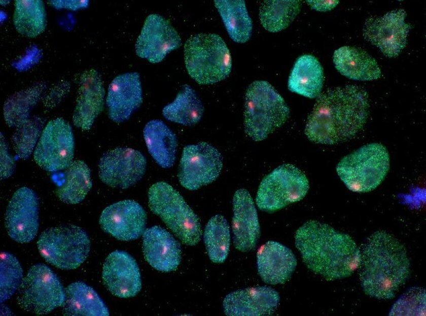 Clinical trials funded by the California Institute for Regenerative Medicine (CIRM) includes work on so-called induced pluripotent stem cells (iPS cells), which are depicted here.