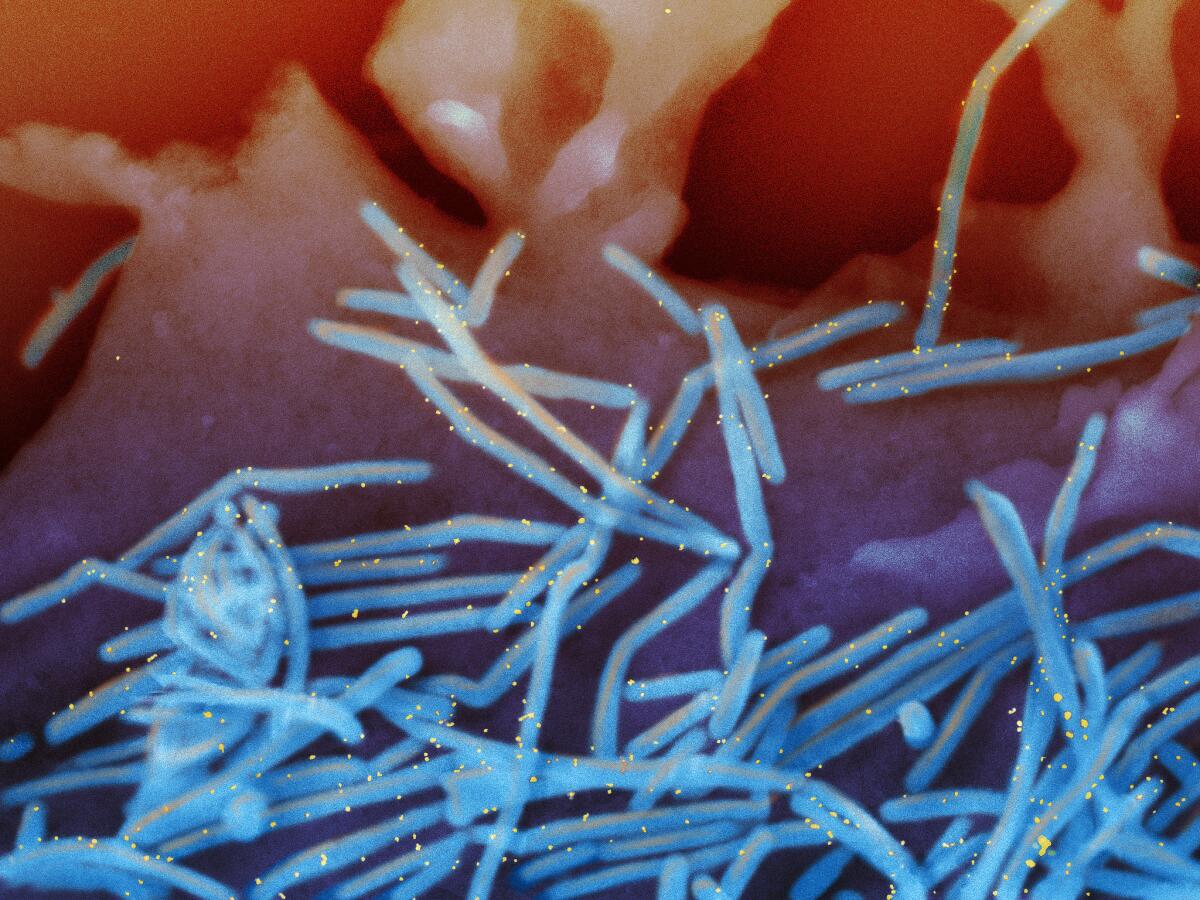 Human respiratory syncytial virus (RSV) virions are colorized blue in this electron microscope image.