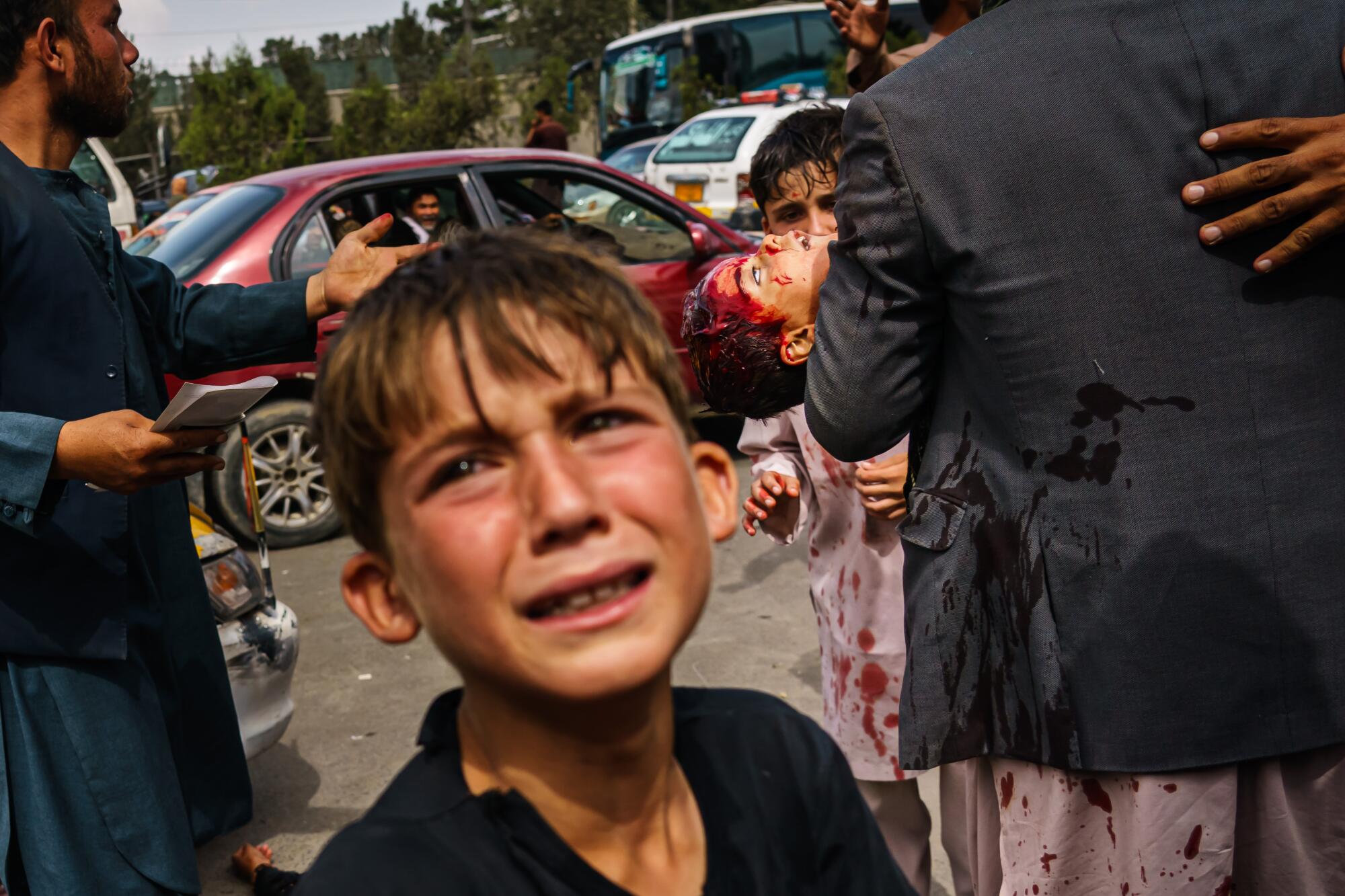 A child cries as a man carries another child, badly bloodied. 