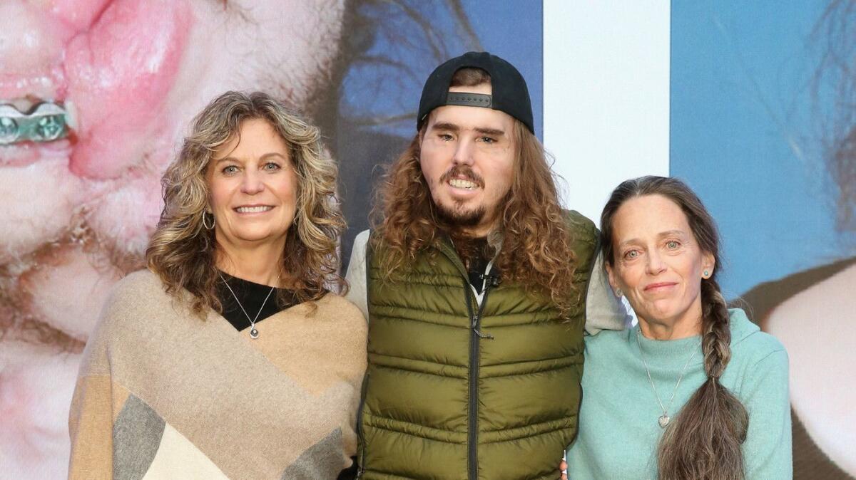 Cameron Underwood is flanked by his mother, Bev Bailey-Potter, left, and Sally Fisher, the mother of his donor at a news conference Thursday.