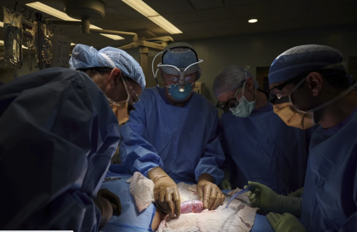 un equipo quirúrgico examina un riñon. (ASSOCIATED PRESS)
