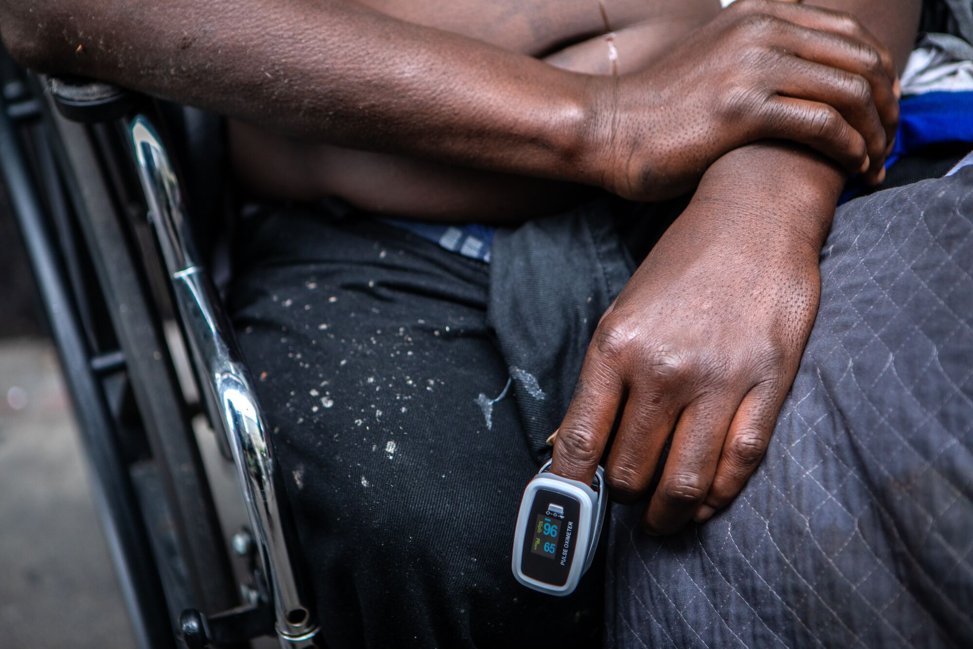 A devise attached to a man's finger registers oxygen levels.