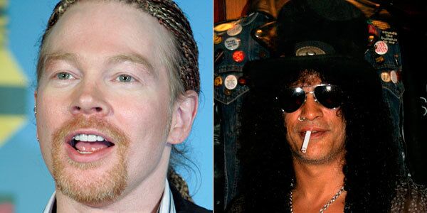 axl rose before and after