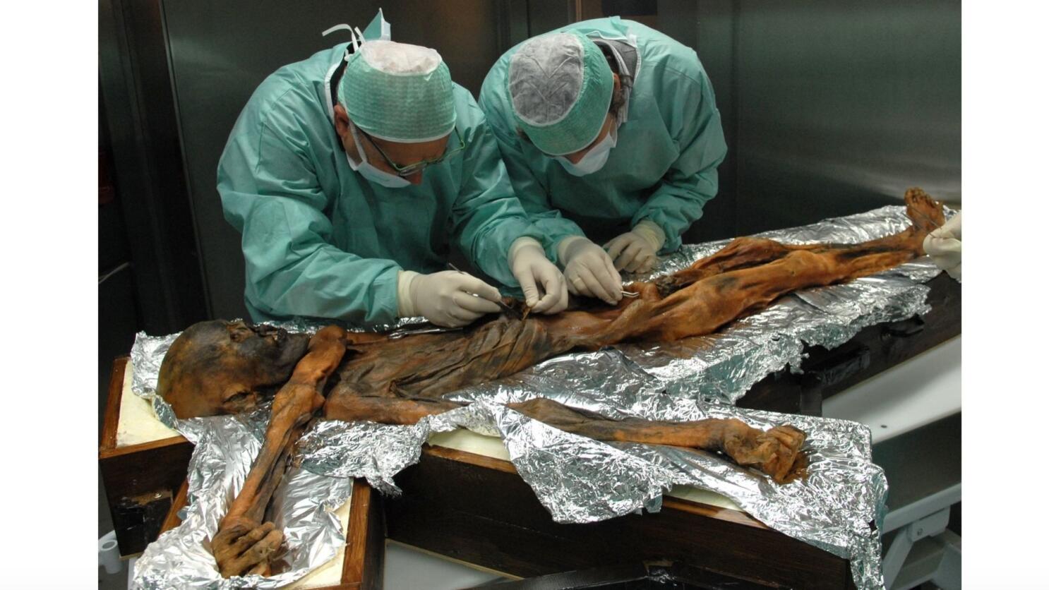 5,000-Year-Old Mummified Iceman Revealed As Balding Farmer