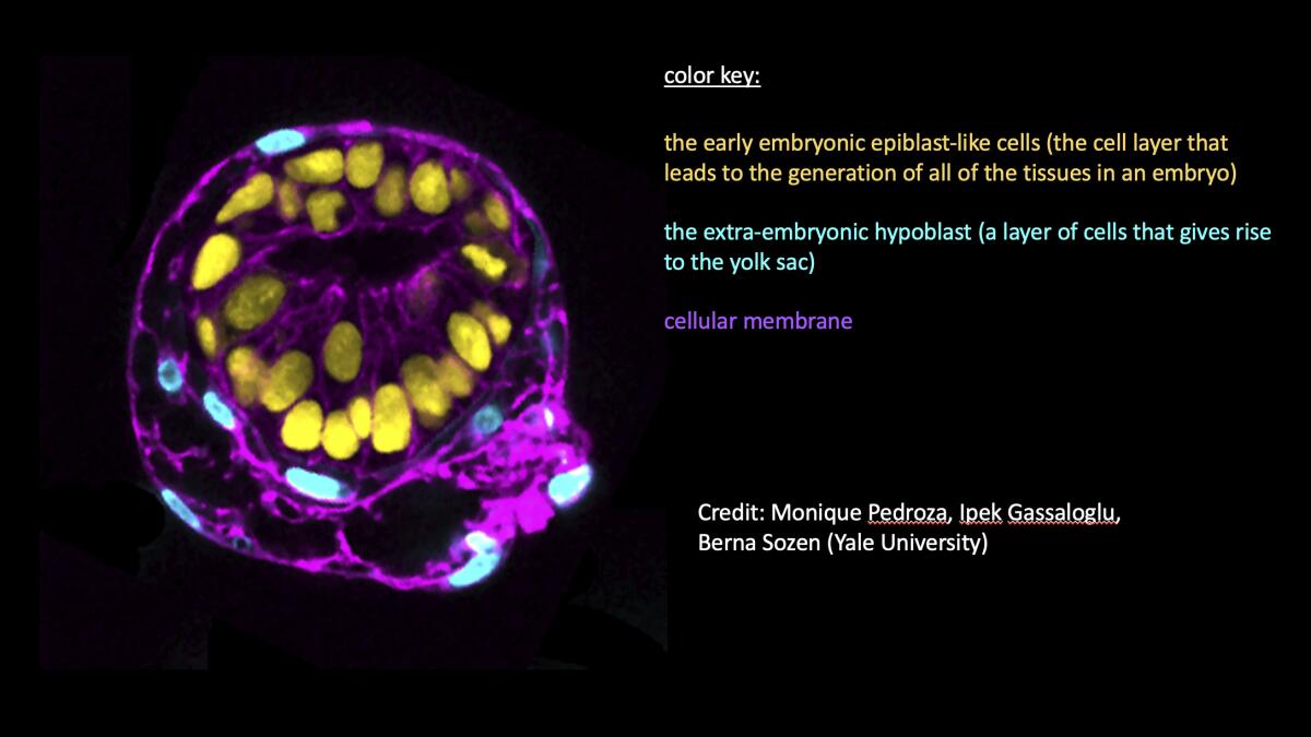 A graphic showing an image of a human embryo model