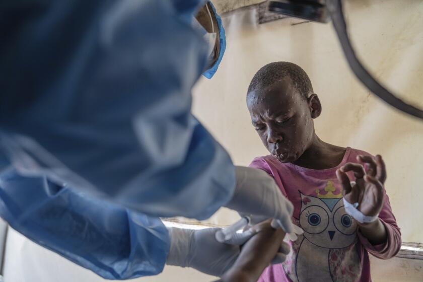 ARCHIVO - Personal de salud atiende a un paciente con viruela símica en un centro de tratamiento en Munigi, en la República Democrática del Congo, el 19 de agosto de 2024. (AP Foto/Moses Sawasawa, archivo)