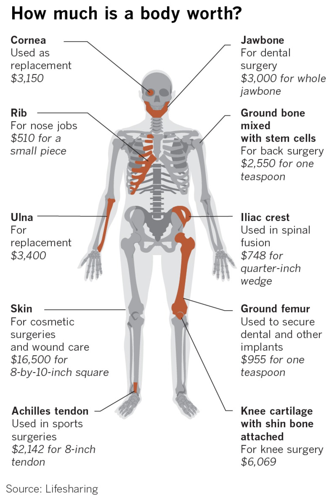 462298-w0-la-fi-body-parts-coroners-explainer.jpg