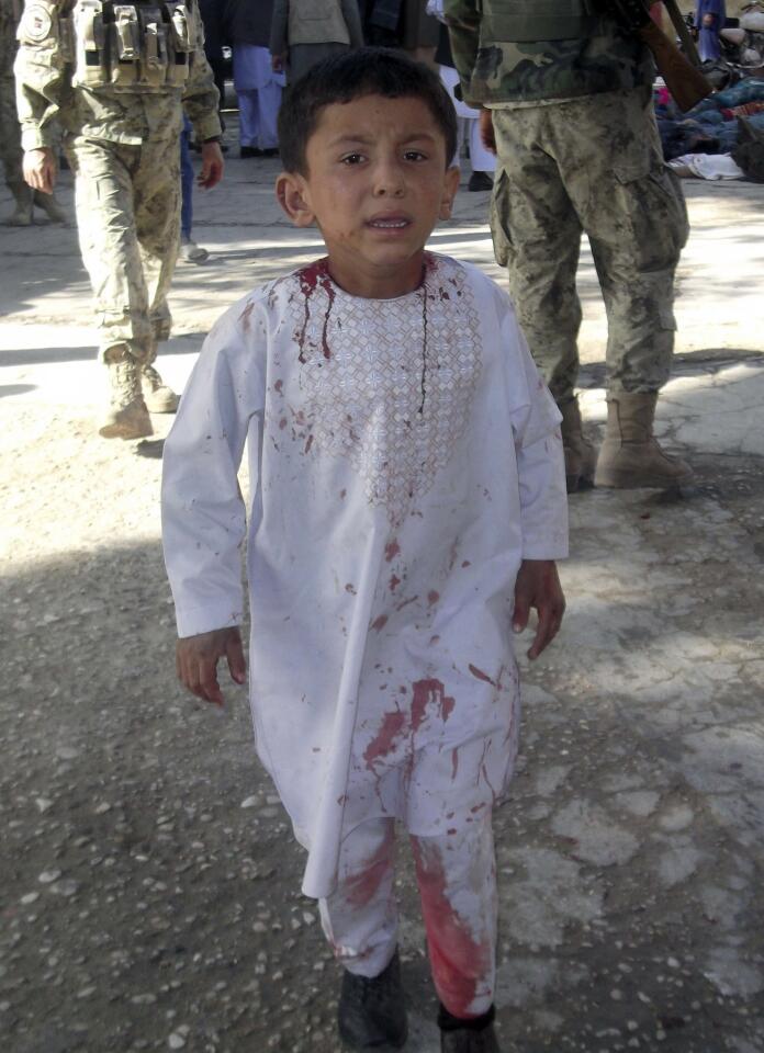 An Afghan boy, who lost his father in a suicide attack, walks around a hospital in a daze in Maymana.