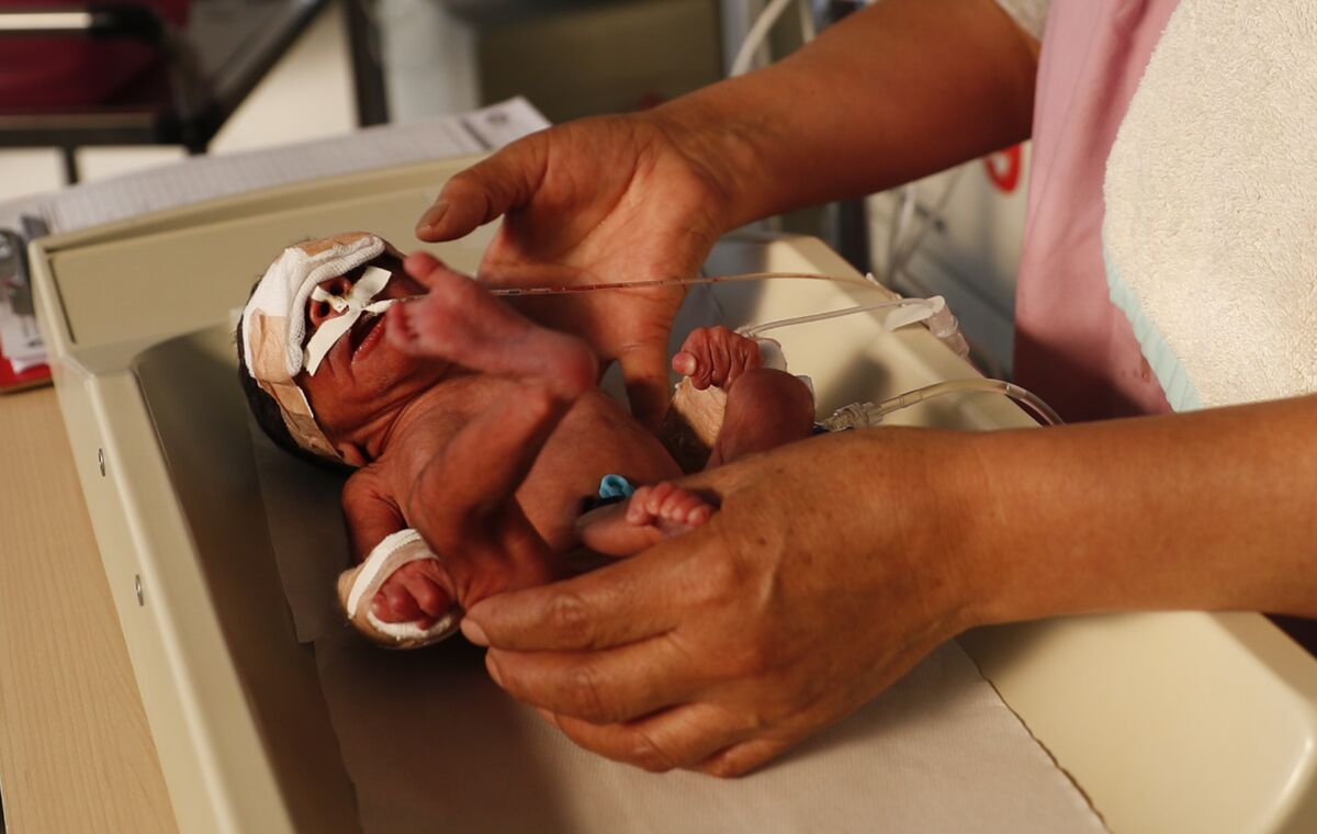 A nurse attends to a newborn baby in the intensive care unit of the Women's Hospital maternity ward in La Paz, Bolivia, Thursday, Aug. 13, 2020. Doctors say the supply of oxygen for the babies is becoming scarce, the result of nationwide blockades by supporters of the party of former President Evo Morales who object to the recent postponement of elections. Bolivia's political and social crisis is coinciding with the continued spread of the new coronavirus across one of Latin America's poorest countries. (AP Photo/Juan Karita)