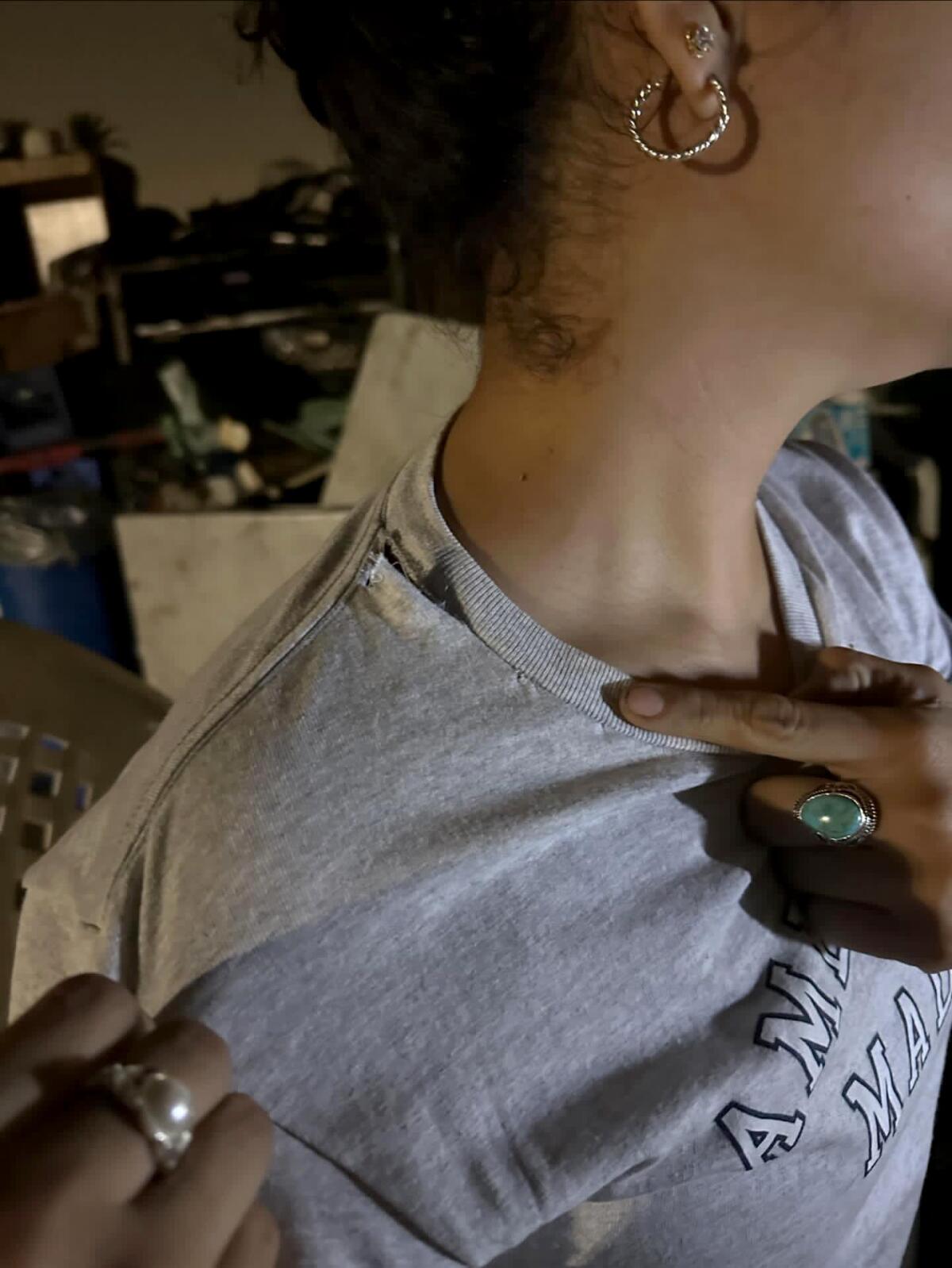 A woman shows the right side of her neck.