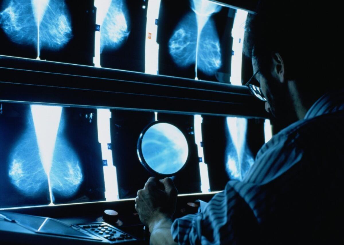Radiologists have long been able to see calcifications in the arteries leading to women's breasts. A new study lays the groundwork for using that information to screen women for heart disease.