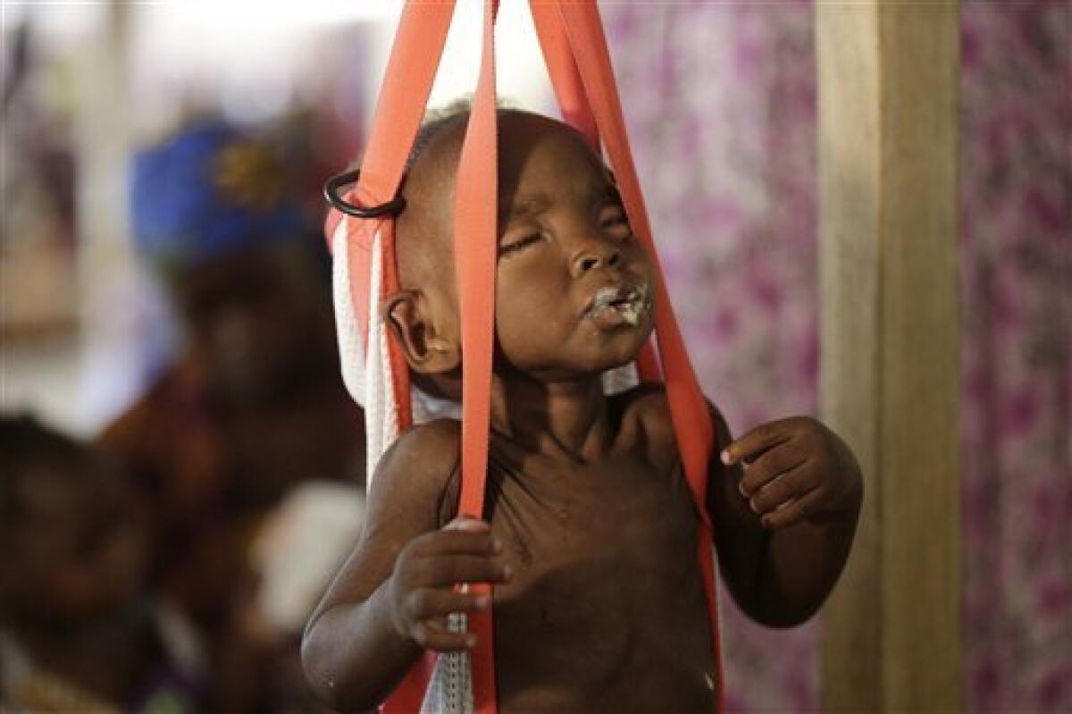 En esta imagen de archivo, tomada el 29 de agosto de 2016, un niño malnutrido se pesa en una báscula en una clínica gestionada por Médicos Sin Fronteras en Maiduguri, Nigeria. Unos 75.000 niños podrían morir en el próximo año por la hambruna generada por Boko Haram en Nigeria si los donantes no responden pronto, advirtió la agencia de Naciones Unidas para la Infancia, UNICEF.