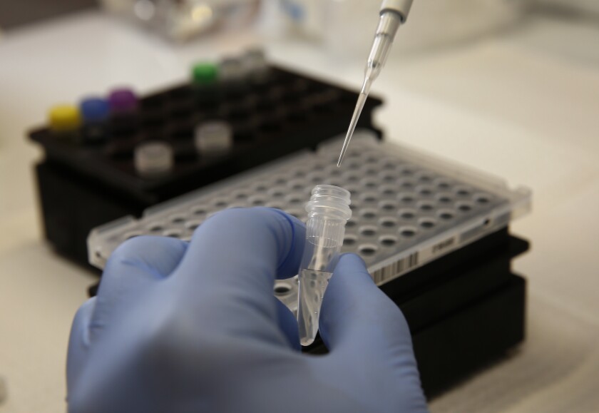 Brian Bowland, a lab specialist the UCLA Health System, works on a coronavirus testing kit.
