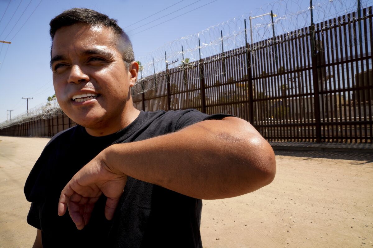 Jose "Andy" Lopez shows the scar on his arm he says he suffered during a violent arrest by a CBP officer