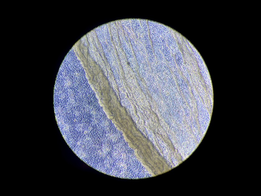 A microscopic view of rattlesnake venom destroying cells.