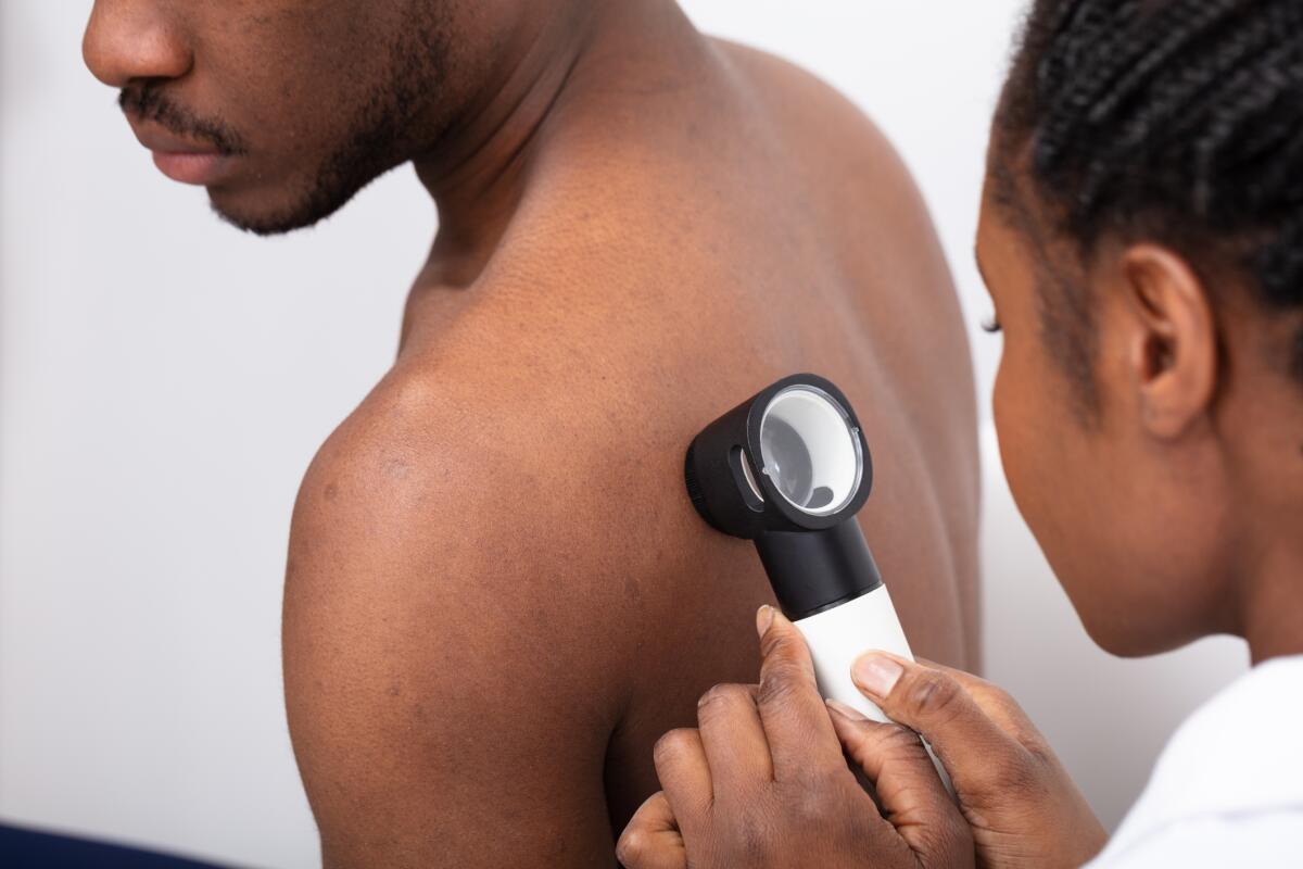 Close-up of a female doctor checking pigment of skin on man's back with a dermatoscope.