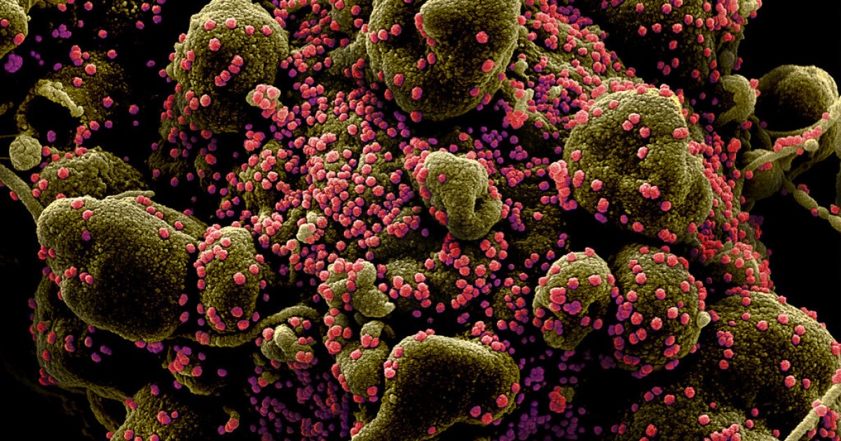 Coronavirus outbreak at Kaiser San Jose Hospital infected 43