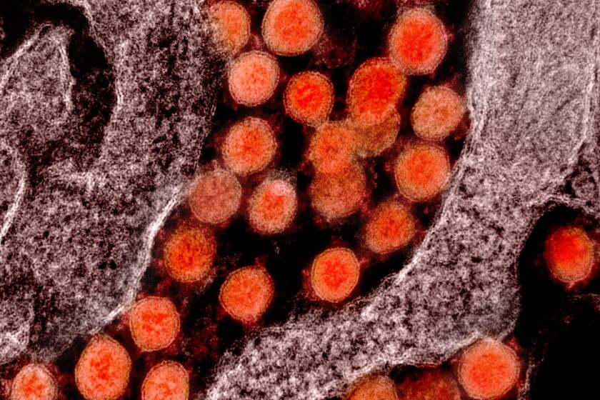 Transmission electron micrograph of new coronavirus particles, isolated from a patient.