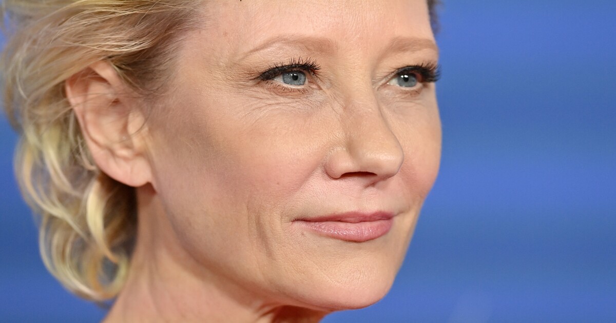 Anne Heche is ‘brain dead’ but remains on life support for organ donation, rep says