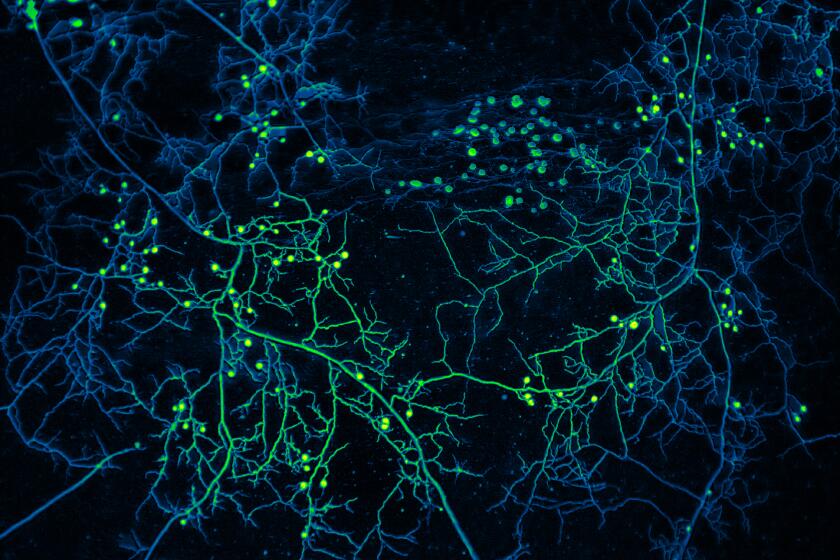 Mycelium of arbuscular mycorrhizal fungi with false color.