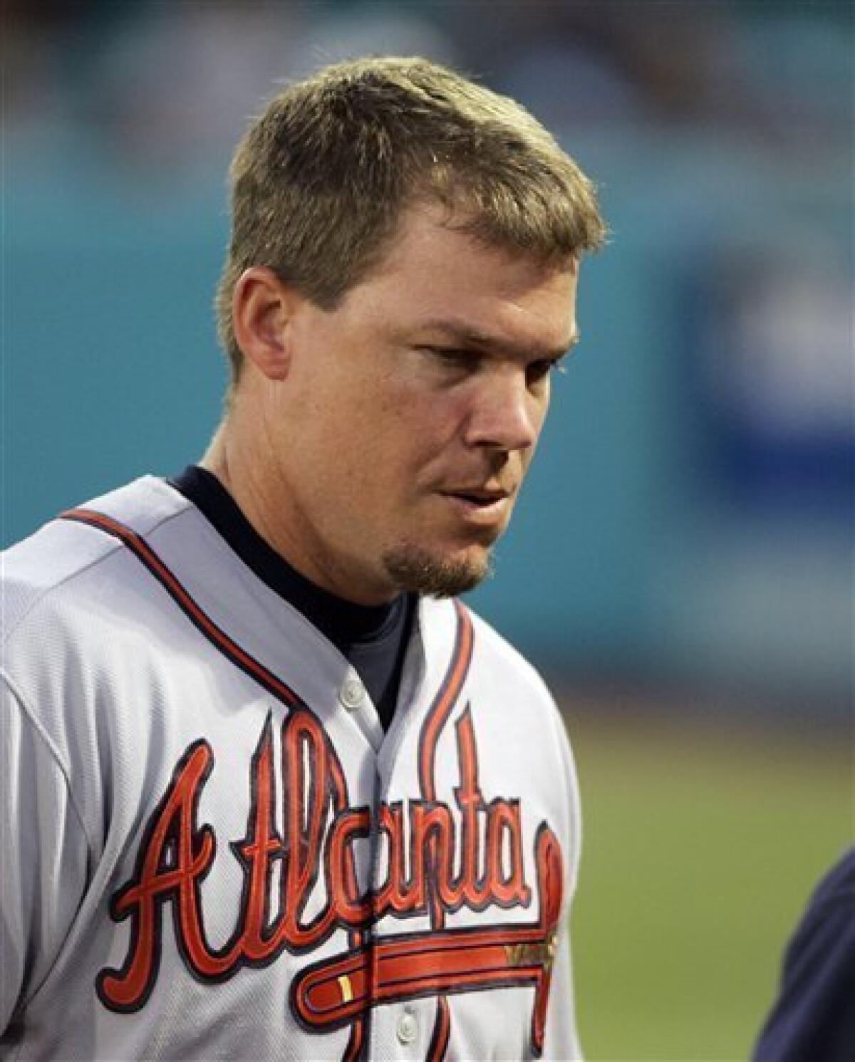 Chipper Jones Likely To Miss Weekend With Leg Contusion 