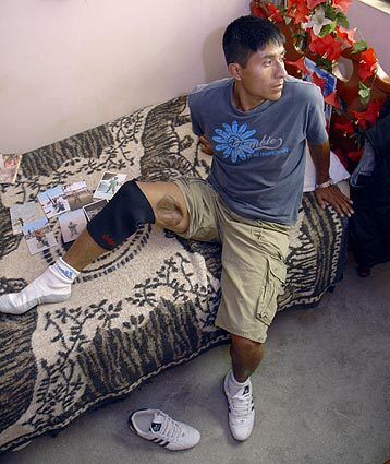 Calixto, 27, spent a month in U.S. and British hospitals in Iraq recovering from the shrapnel wound to his thigh. He uses a hearing aide after his left eardrum was punctured during the mortar shell attack. Although he has no complaints about his treatment in Iraq, he says it's been hard getting help back in Peru.