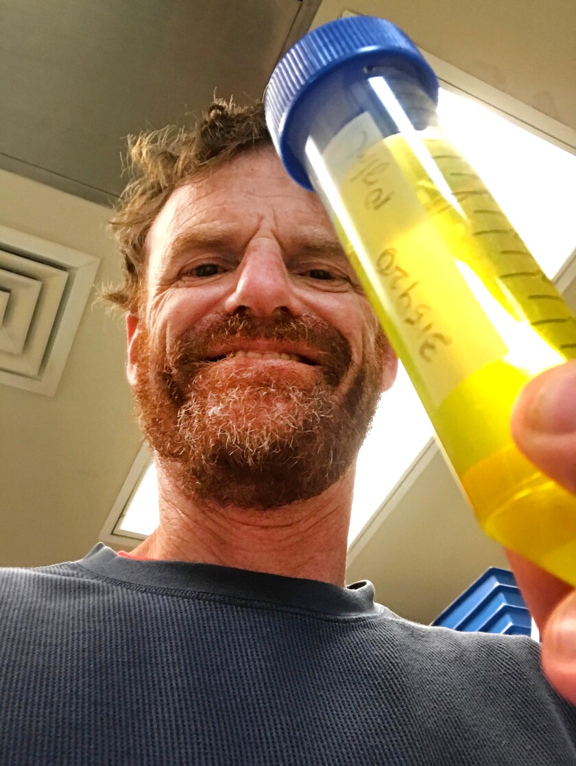 Dr. Matthew Lewin holds up a vial containing varespladib, a drug being tested for snakebite treatment.