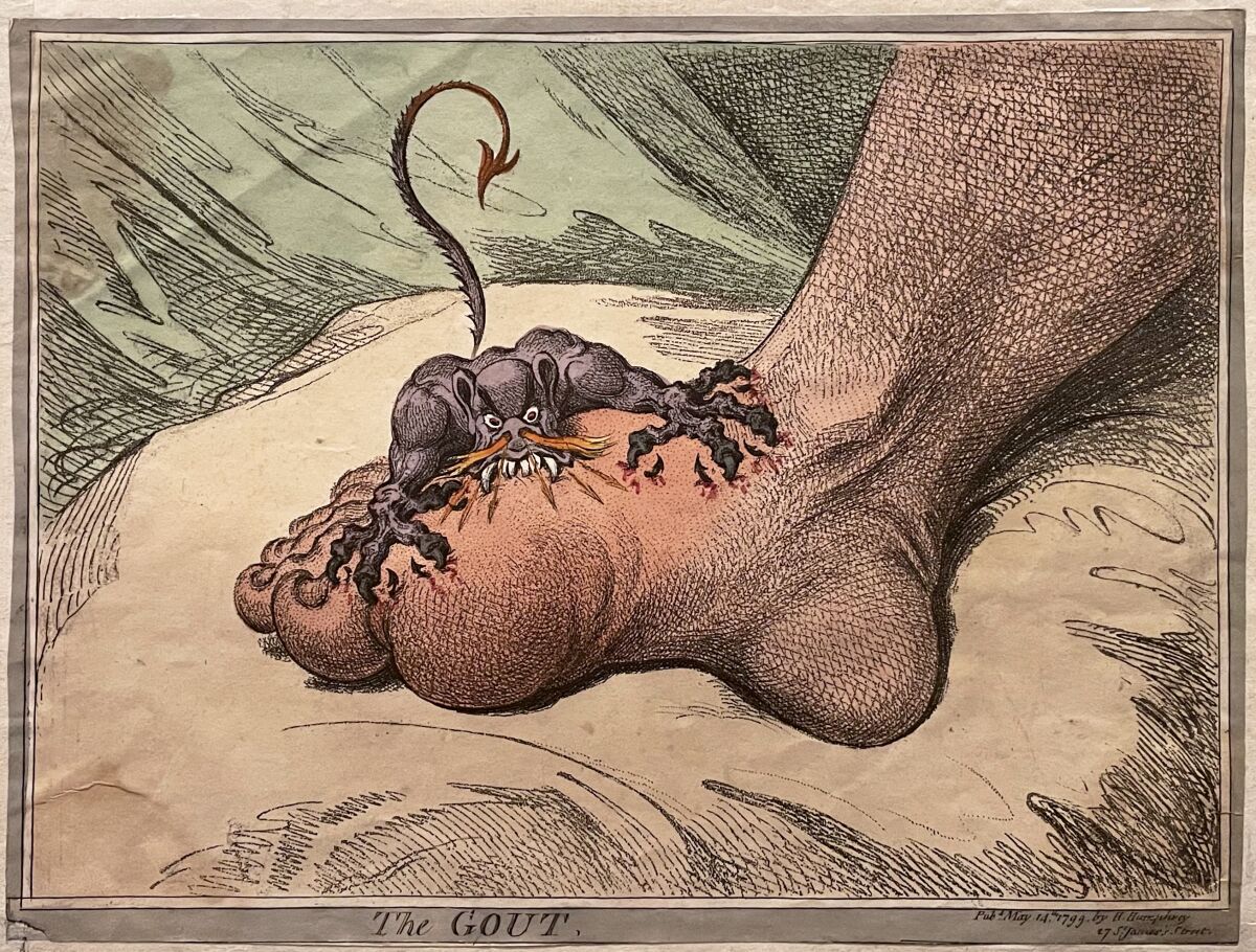 James Gillray's "The Gout," 1799, etching and aquatint with hand-coloring