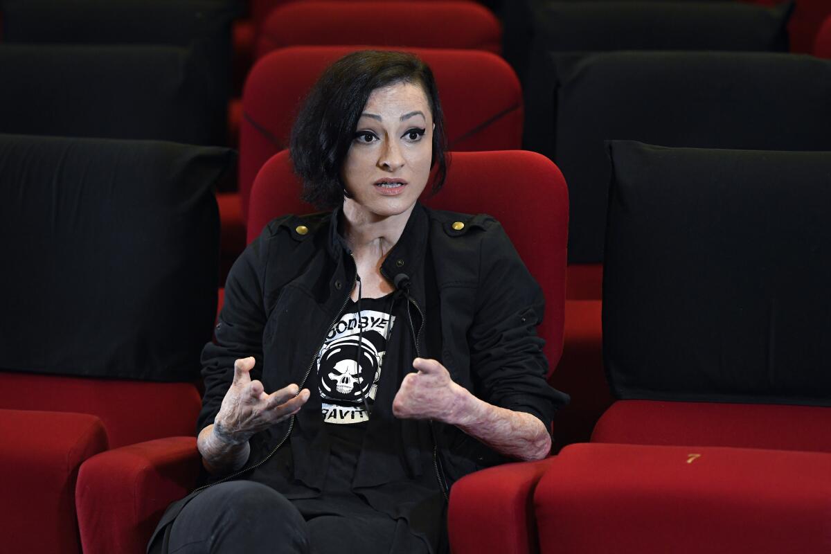 Tedy Ursuleanu, a survivor of the Colectiv nightclub fire, speaks during an interview with the Associated Press at the Elvire Popesco cinema in Bucharest, Romania, Monday, April 12, 2021. The Oscar-nominated Romanian documentary film “Collective” follows a group of journalists delving into the state of health care in the eastern European country in the wake of a deadly 2015 nightclub fire that left dozens of burned victims in need of complex treatment. What they revealed was decades of deep-rooted corruption, a heavily politicized system scarily lacking in care. (AP Photo/Andreea Alexandru)