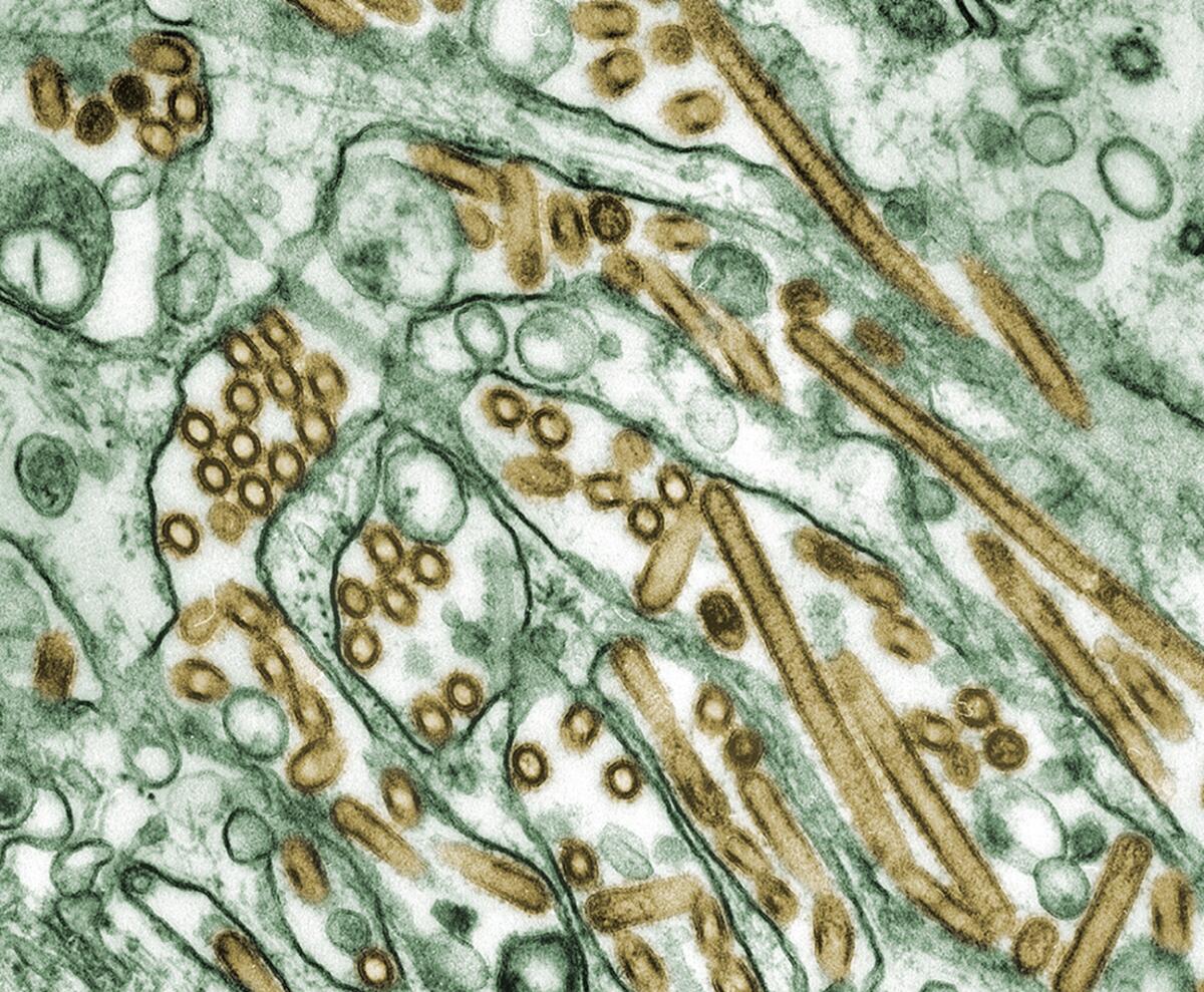 A microscope image of H5N1 virus particles 
