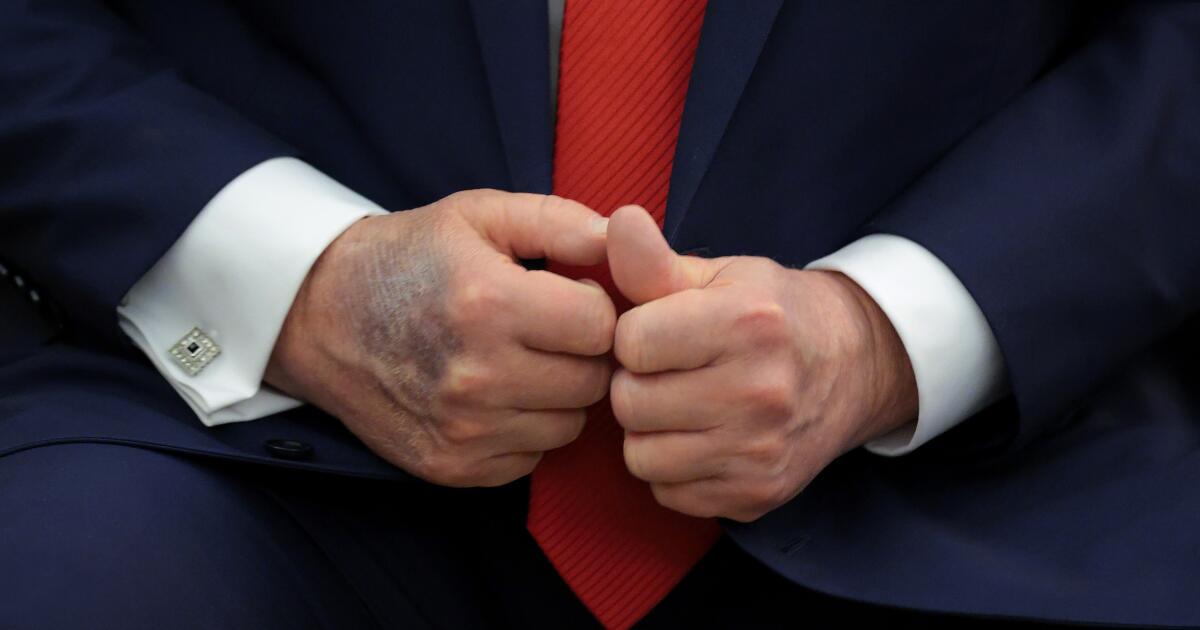 Contributor: Trump is previous and ailing, however Democrats should not depend on time to resolve their downside Contributor: Trump is previous and ailing, however Democrats should not depend on time to resolve their downside