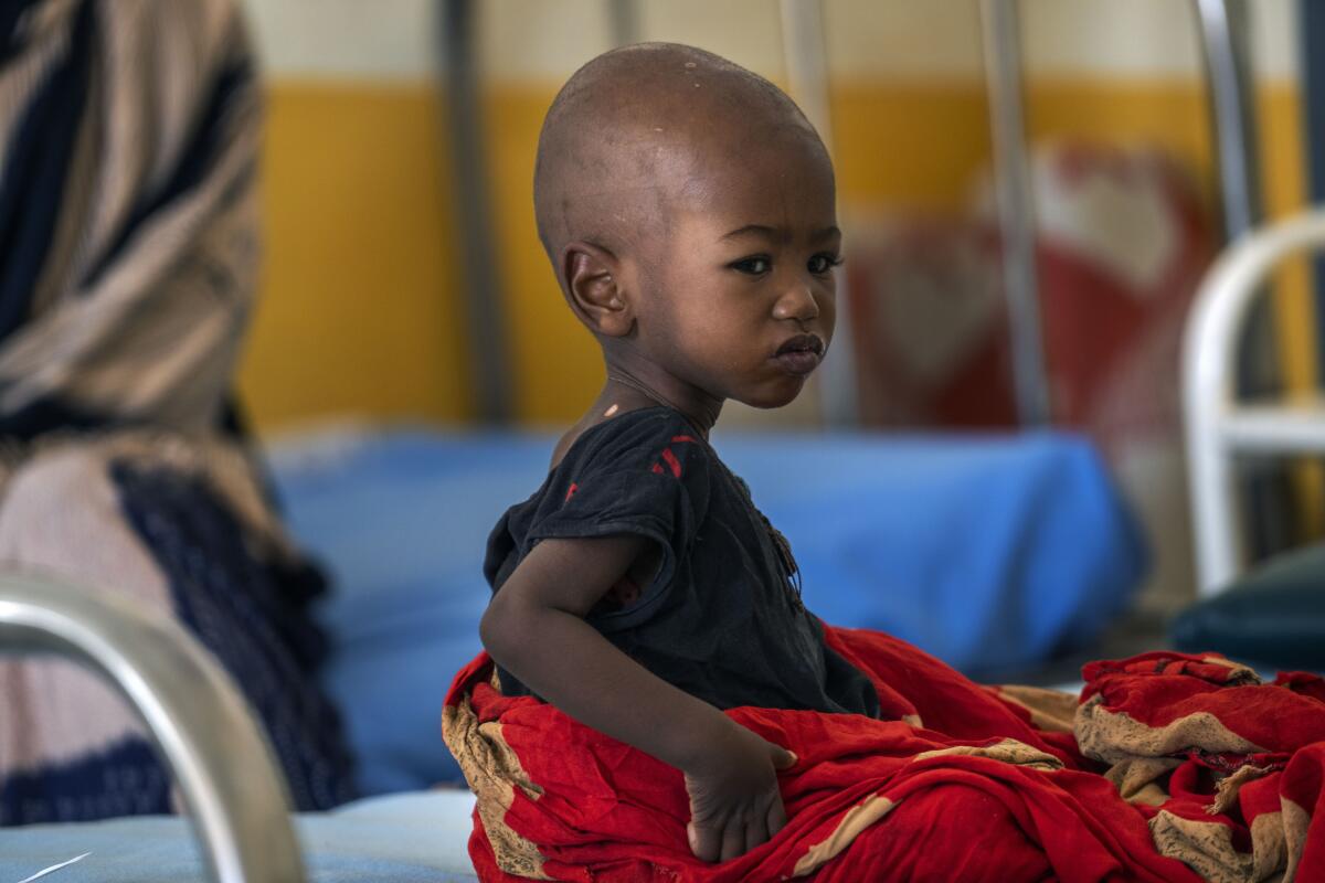 A malnourished child with clean-shaven head and lap covered with a red blanket sits at a clinic