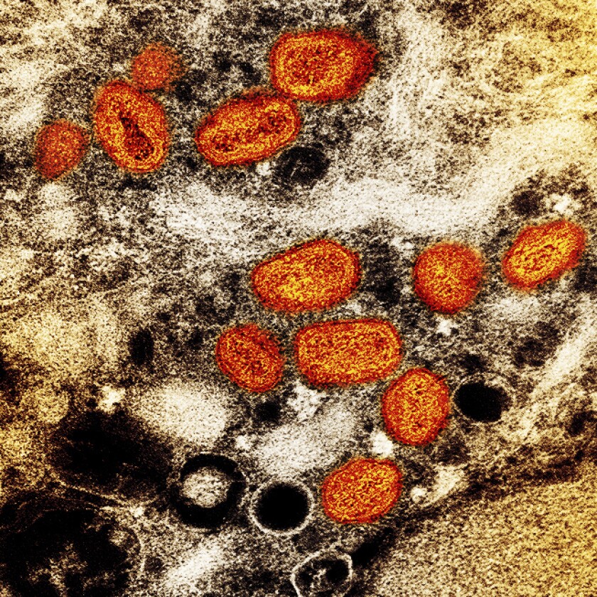 Monkeypox particles, colored orange, are seen through a transmission electron microscope.