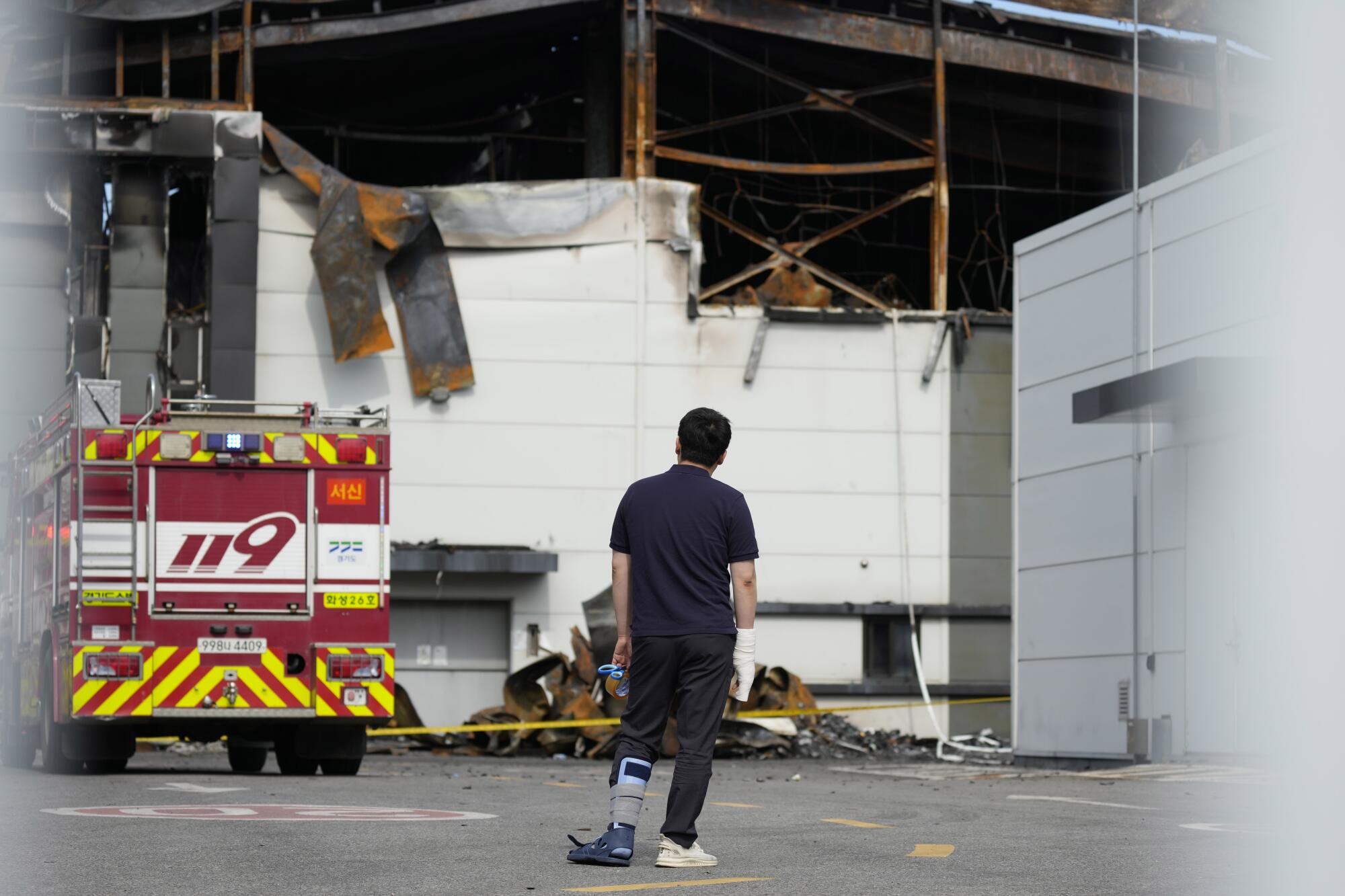A man with an injured leg looks at a building with a fire truck parked in front.