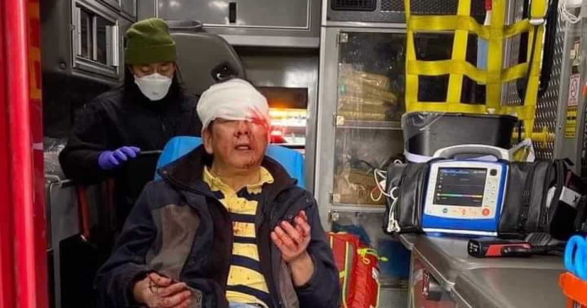 Brutal attacks on scars Asian residents in San Francisco