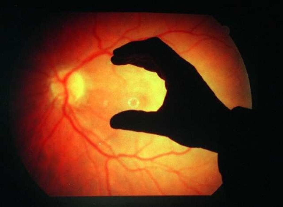 A retina destroyed by macular degeneration.