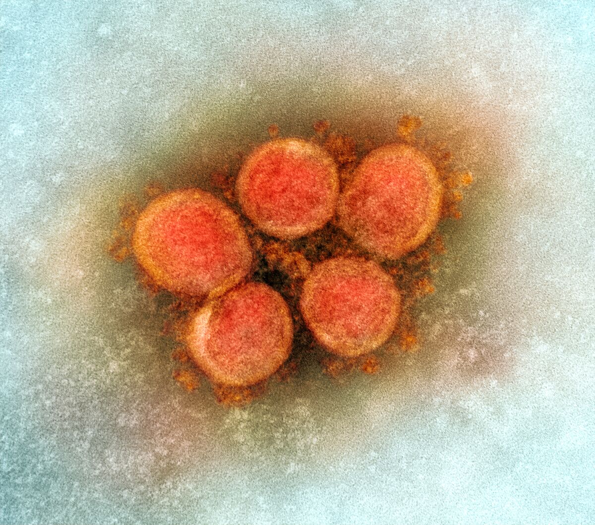 Five orange-red round objects on a blue background.