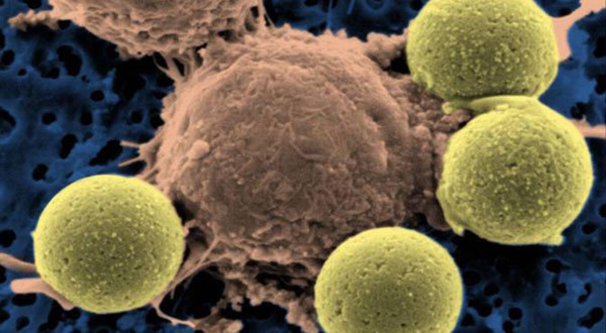 This microscopy image shows immune system T-cells. A new therapy that supercharges the body's T-cells has shown promise in treating leukemia.