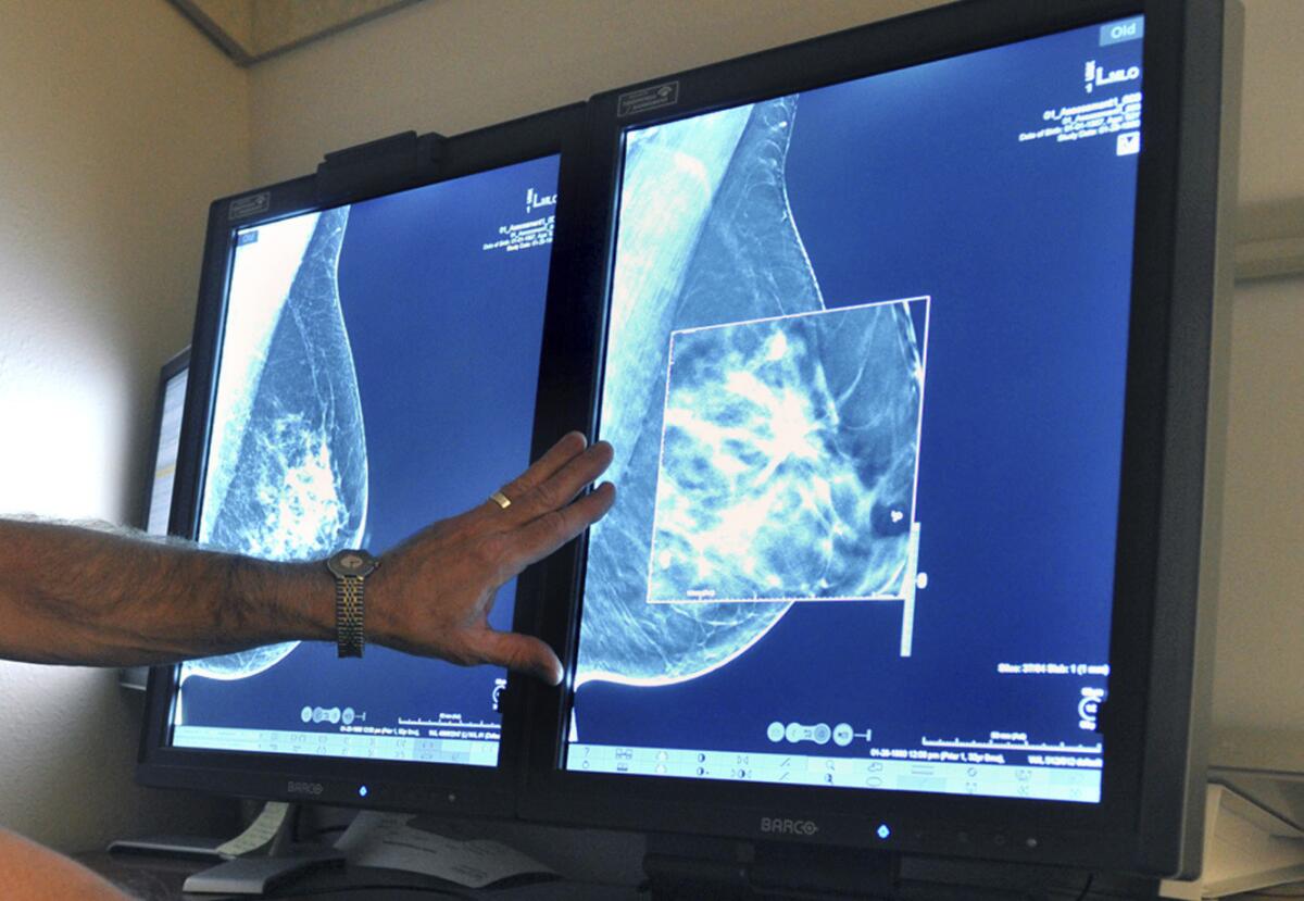 A radiologist compares a 2-D mammogram image (left) with a newer 3-D image.