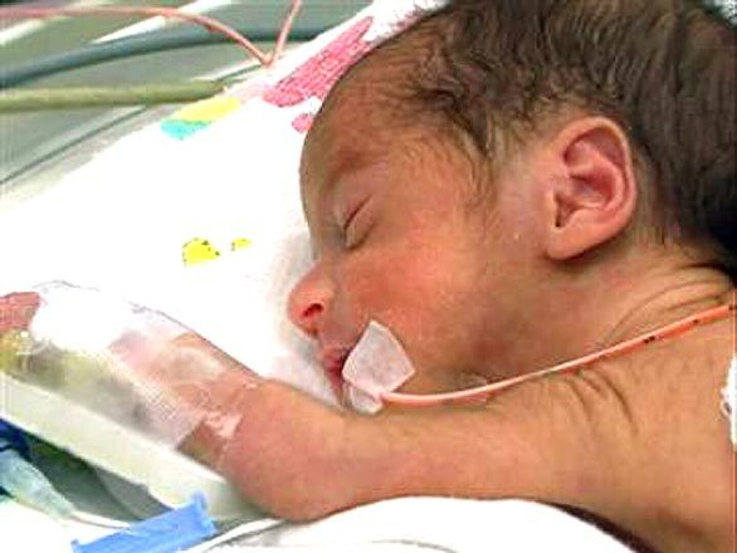 Octuplets' first photos - Los Angeles Times