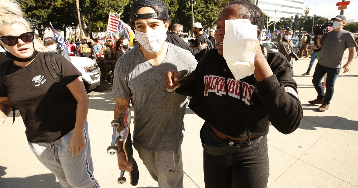 Black woman describes terrible mob mob attack in Los Angeles
