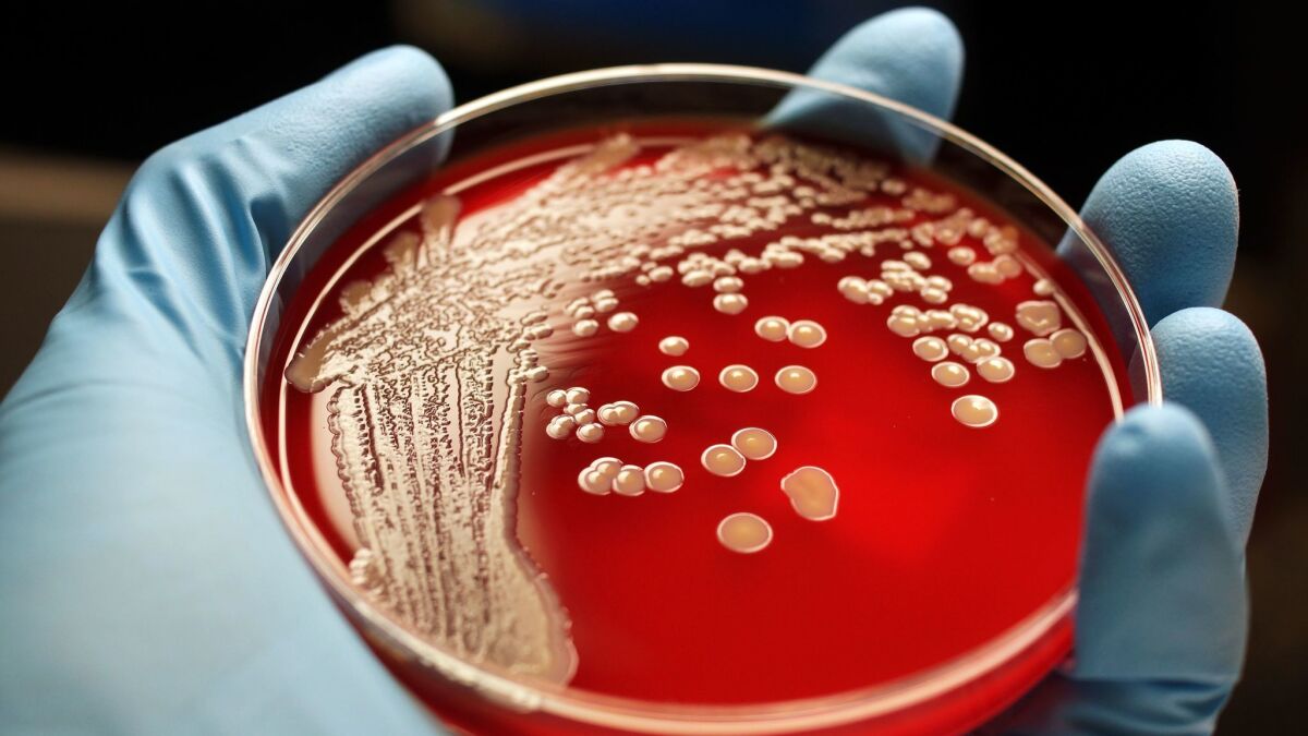 MRSA colonies on blood agar plate.