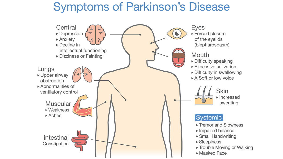 Parkinson's disease symptoms and signs. Illustration about medical diagram.